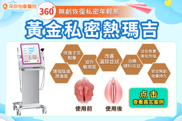香港縮陰手術